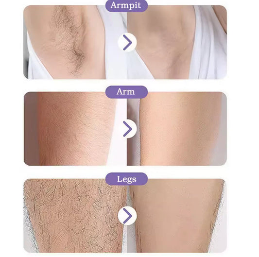 SilkTouch Nano Epilator